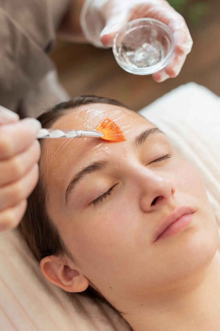 Chemical Peel